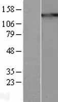 NBL1-16878 - Thrombospondin Lysate